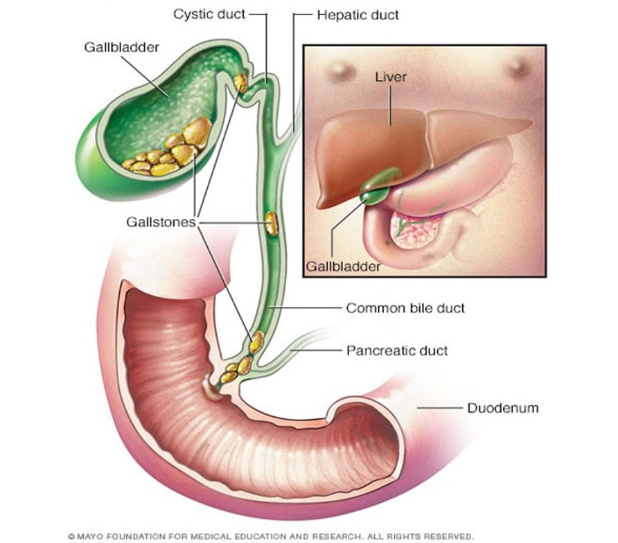 gallbladder-image